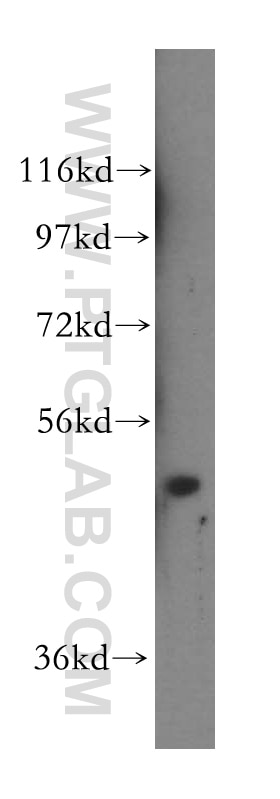 Western Blot (WB) analysis of A549 cells using NFS1 Polyclonal antibody (15370-1-AP)