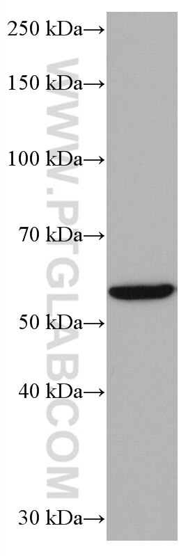 WB analysis of HeLa using 67021-1-Ig