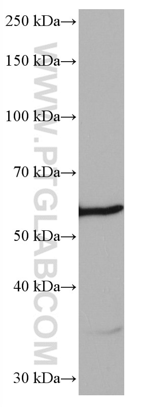 WB analysis of RAW 264.7 using 67021-1-Ig