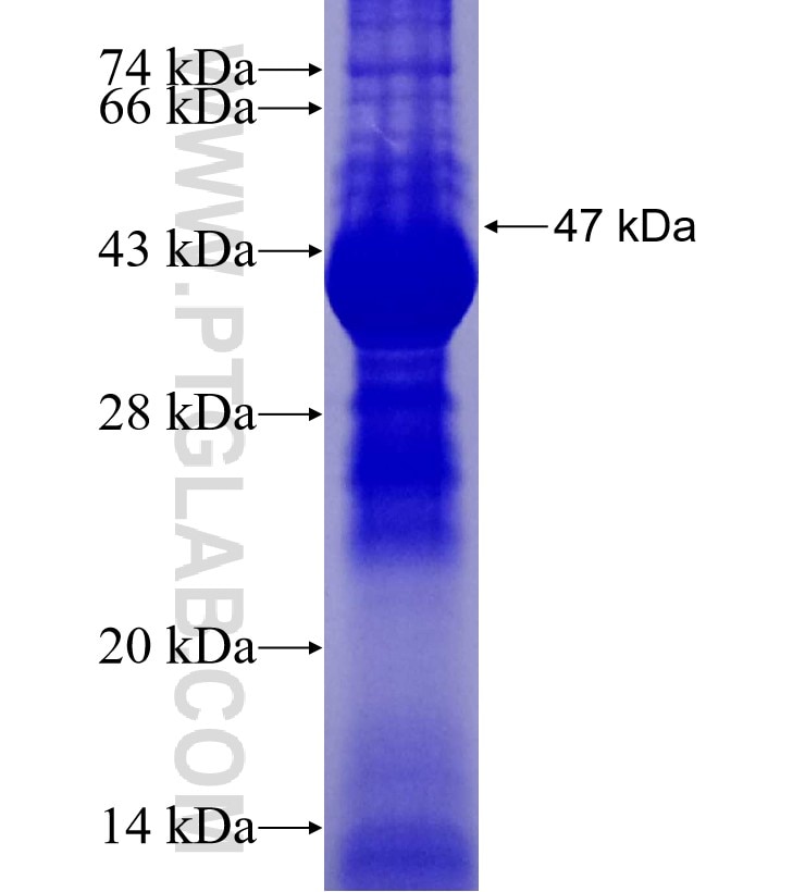 NFS1 fusion protein Ag3872 SDS-PAGE