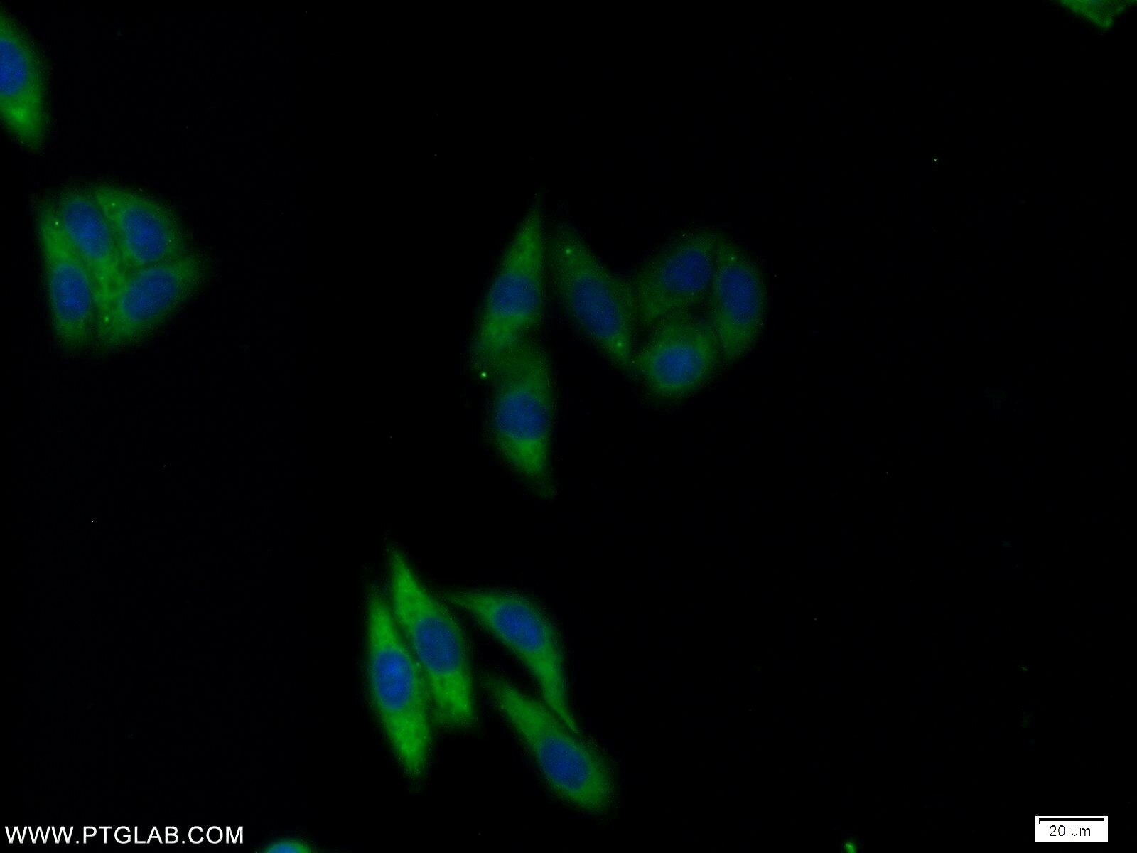 IF Staining of HepG2 using 25598-1-AP