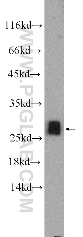 Western Blot (WB) analysis of mouse brain tissue using NFU1 Polyclonal antibody (25598-1-AP)