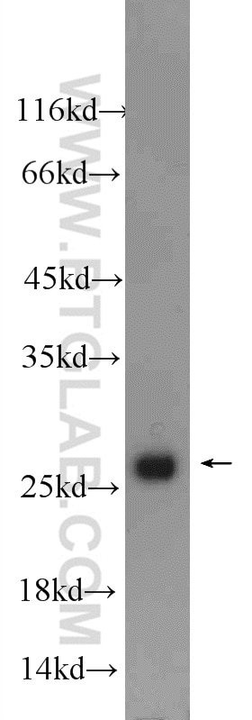 Western Blot (WB) analysis of mouse cerebellum tissue using NFU1 Polyclonal antibody (25598-1-AP)