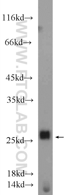 Western Blot (WB) analysis of mouse testis tissue using NFU1 Polyclonal antibody (25598-1-AP)