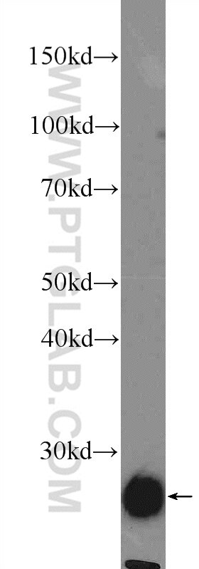 WB analysis of mouse cerebellum using 25598-1-AP