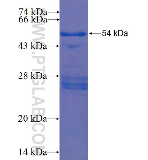 NFU1 fusion protein Ag22343 SDS-PAGE
