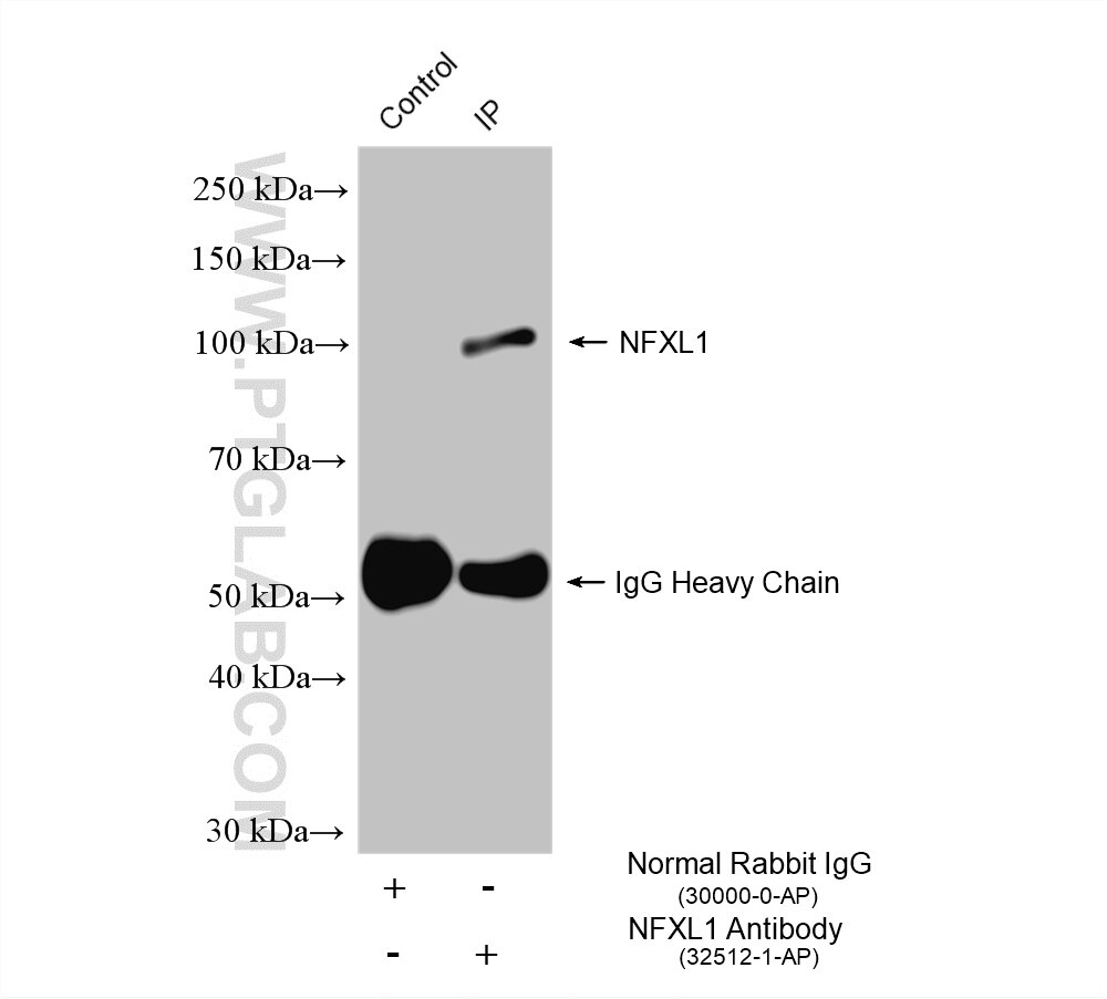 IP experiment of K-562 using 32512-1-AP Immunoprecipitation (IP) experiment of K-562 cells using NFXL1 Polyclonal antibody (32512-1-AP)