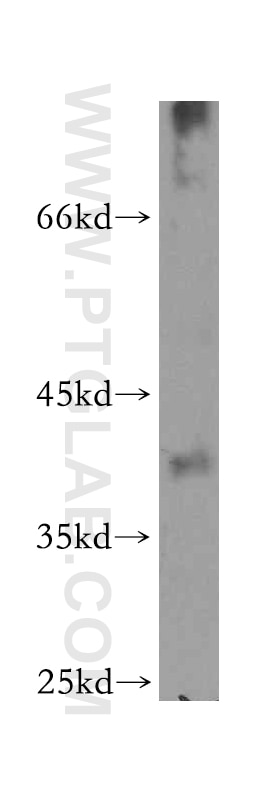 Western Blot (WB) analysis of HeLa cells using NFYA Polyclonal antibody (12981-1-AP)