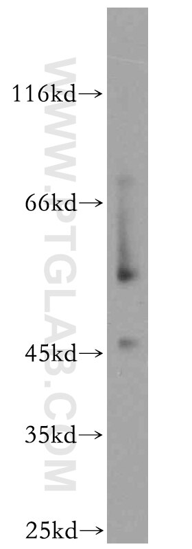 Western Blot (WB) analysis of Jurkat cells using NFYA Polyclonal antibody (12981-1-AP)