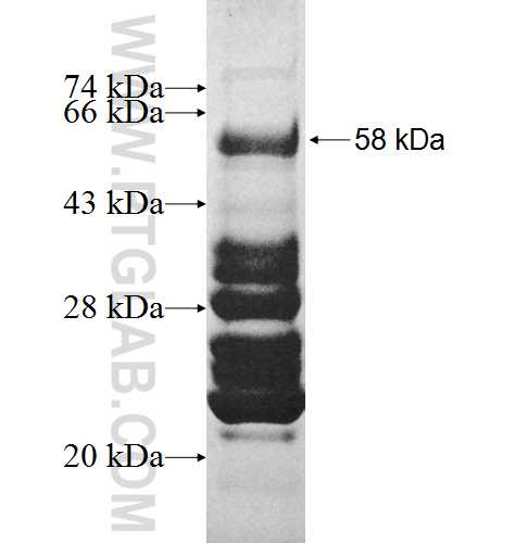 NFYB fusion protein Ag8495 SDS-PAGE