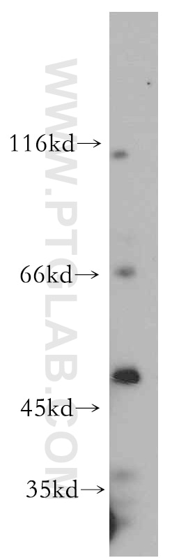 Western Blot (WB) analysis of K-562 cells using NFYC Polyclonal antibody (10129-2-AP)