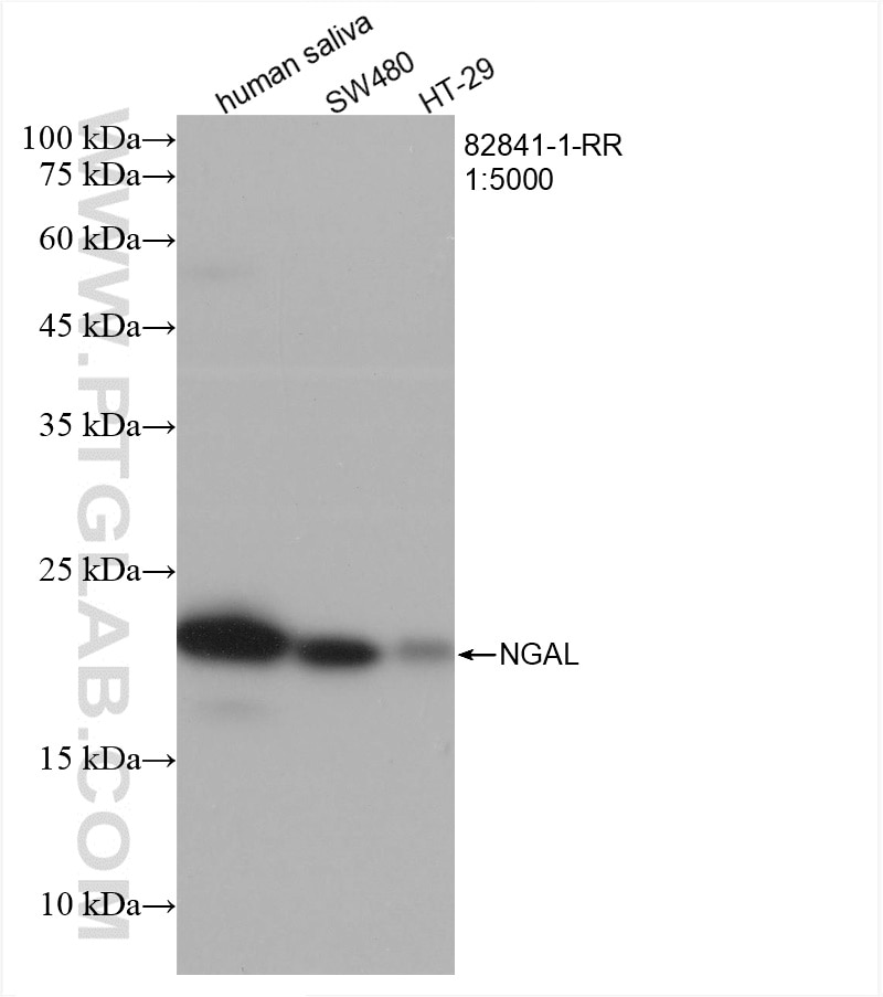 Western Blot (WB) analysis of various lysates using Lipocalin-2/NGAL Recombinant antibody (82841-1-RR)