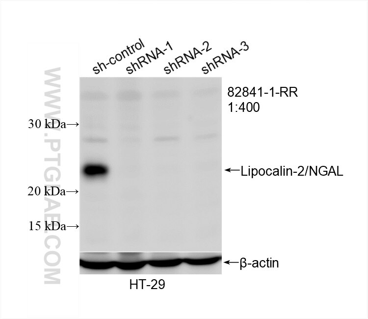 Western Blot (WB) analysis of HT-29 cells using Lipocalin-2/NGAL Recombinant antibody (82841-1-RR)