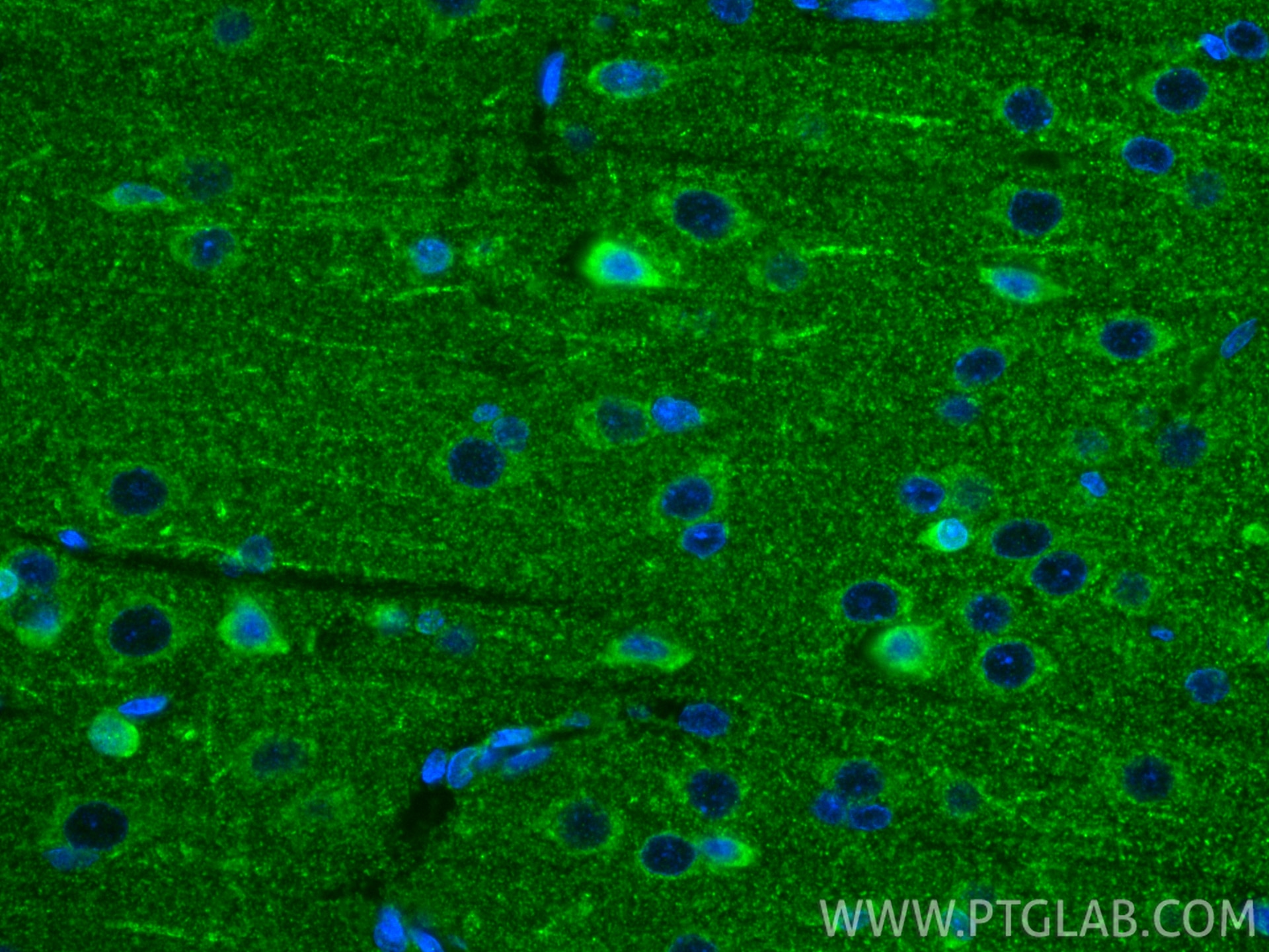 Immunofluorescence (IF) / fluorescent staining of rat brain tissue using NGB Polyclonal antibody (13499-1-AP)