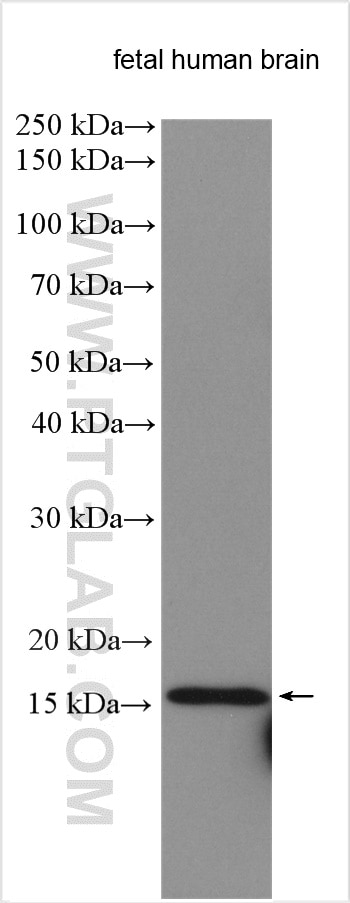 Western Blot (WB) analysis of various lysates using NGB Polyclonal antibody (13499-1-AP)
