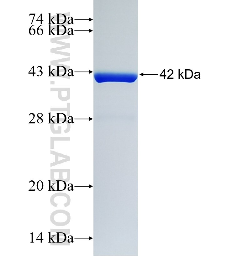 NGB fusion protein Ag4325 SDS-PAGE