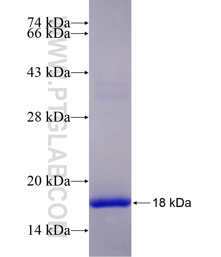 NGB fusion protein Ag4632 SDS-PAGE
