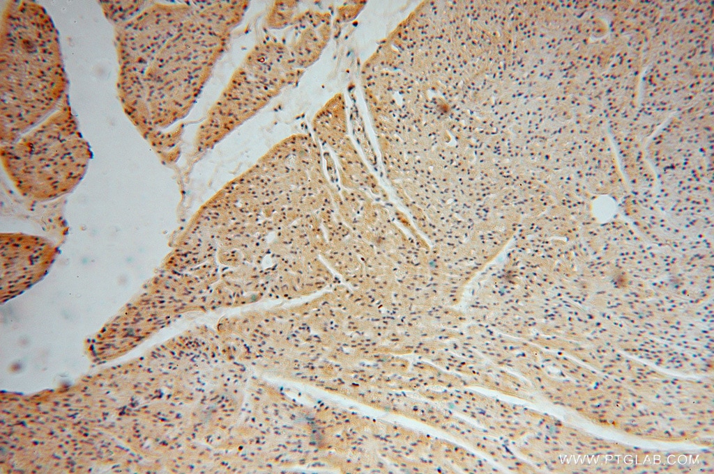 Immunohistochemistry (IHC) staining of human heart tissue using NGDN Polyclonal antibody (16524-1-AP)