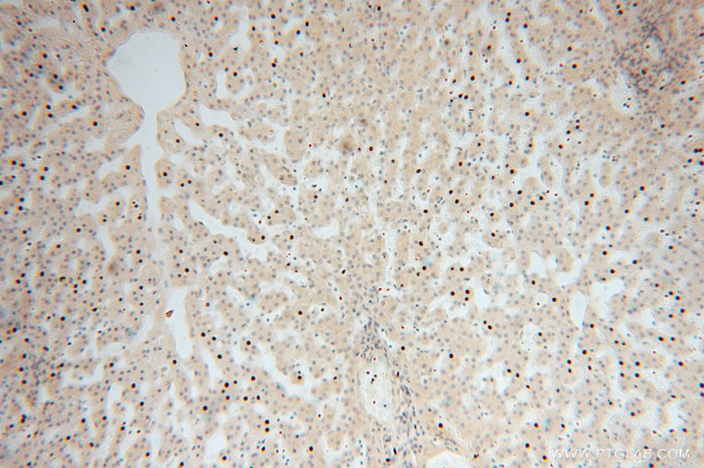 IHC staining of human liver using 16524-1-AP