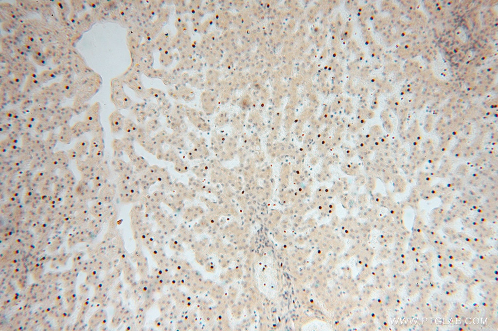 Immunohistochemistry (IHC) staining of human liver tissue using NGDN Polyclonal antibody (16524-1-AP)