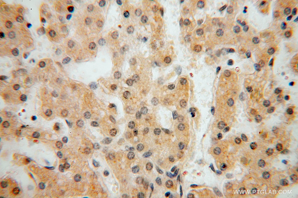 IHC staining of human liver using 16524-1-AP