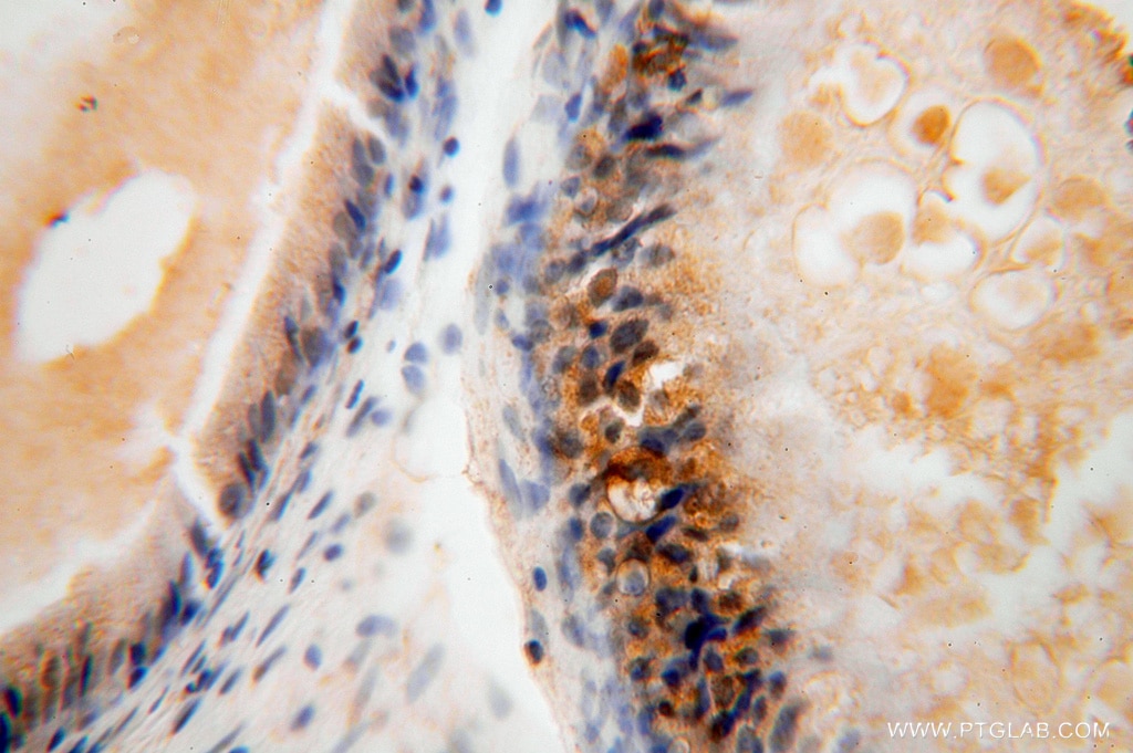 IHC staining of human epididymis using 16524-1-AP