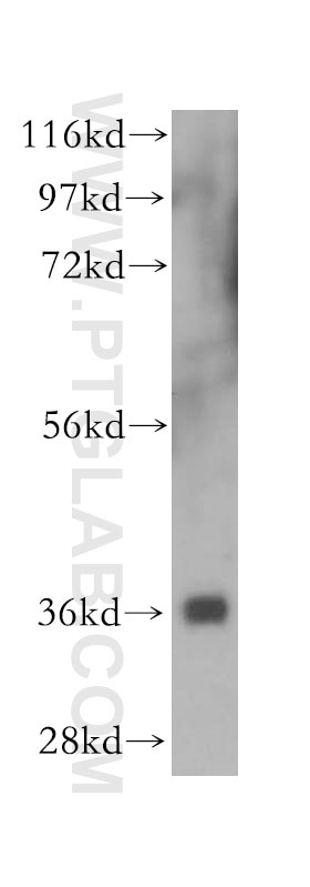 Western Blot (WB) analysis of human cerebellum tissue using NGDN Polyclonal antibody (16524-1-AP)