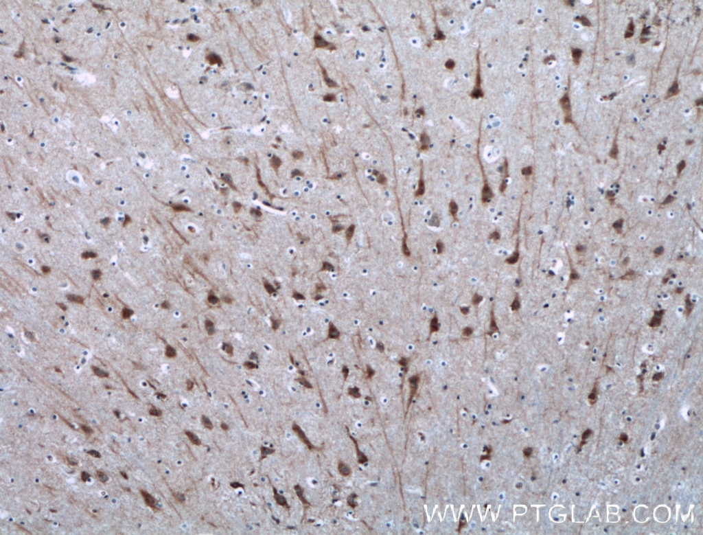 Immunohistochemistry (IHC) staining of human brain tissue using NGEF Polyclonal antibody (13271-1-AP)
