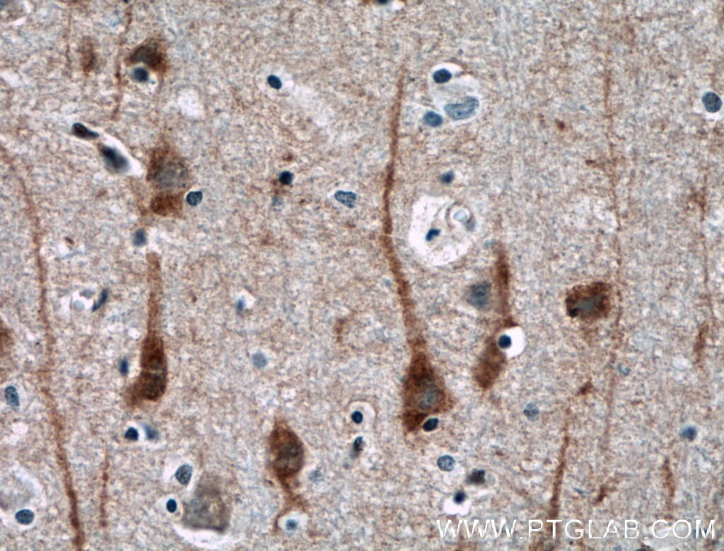 Immunohistochemistry (IHC) staining of human brain tissue using NGEF Polyclonal antibody (13271-1-AP)