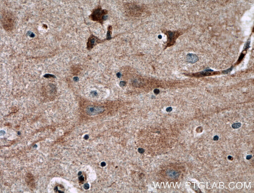 Immunohistochemistry (IHC) staining of human brain tissue using NGEF Polyclonal antibody (13271-1-AP)