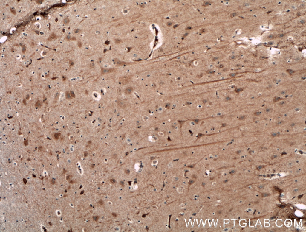 Immunohistochemistry (IHC) staining of human brain tissue using NGEF Polyclonal antibody (13271-1-AP)