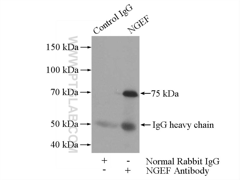 Immunoprecipitation (IP) experiment of mouse brain tissue using NGEF Polyclonal antibody (13271-1-AP)