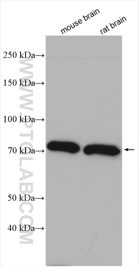 Western Blot (WB) analysis of various lysates using NGEF Polyclonal antibody (13271-1-AP)
