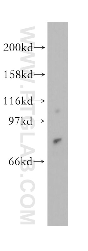 Western Blot (WB) analysis of mouse testis tissue using NGEF Polyclonal antibody (13271-1-AP)