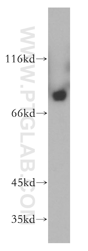 NGEF Polyclonal antibody