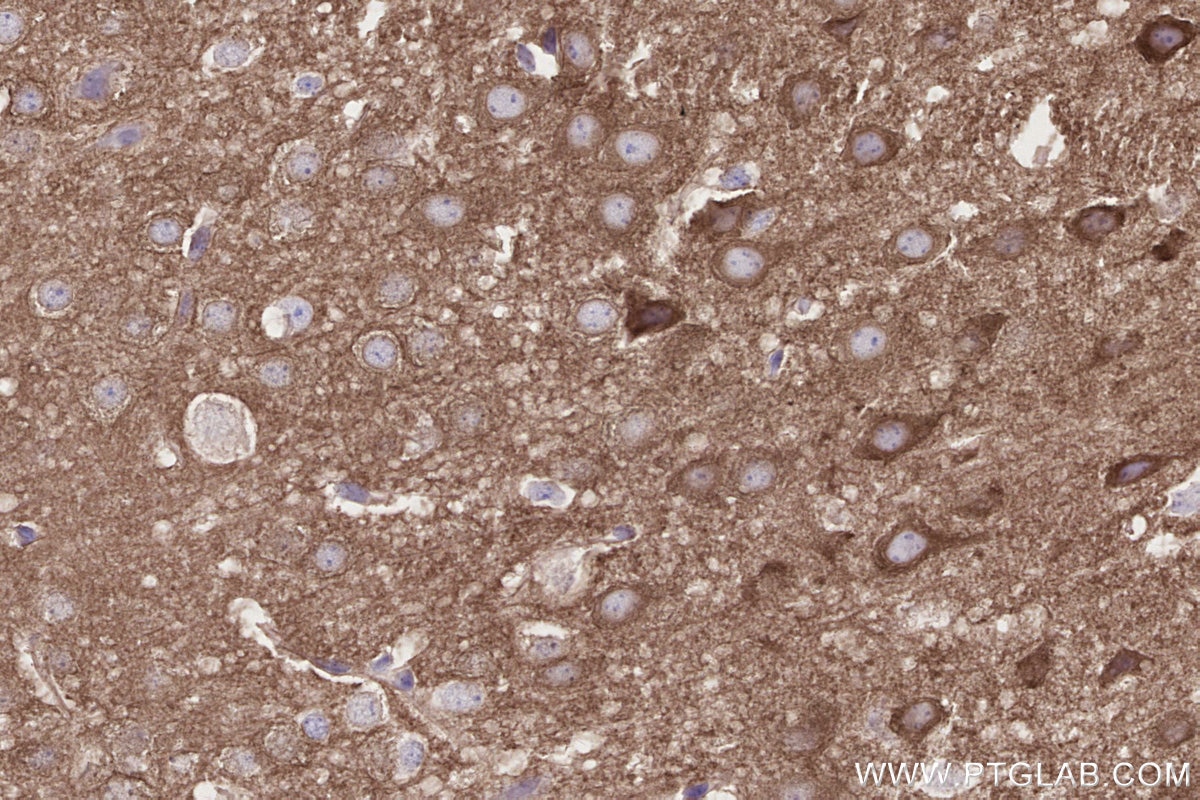 Immunohistochemistry (IHC) staining of mouse brain tissue using NGEF Polyclonal antibody (30229-1-AP)
