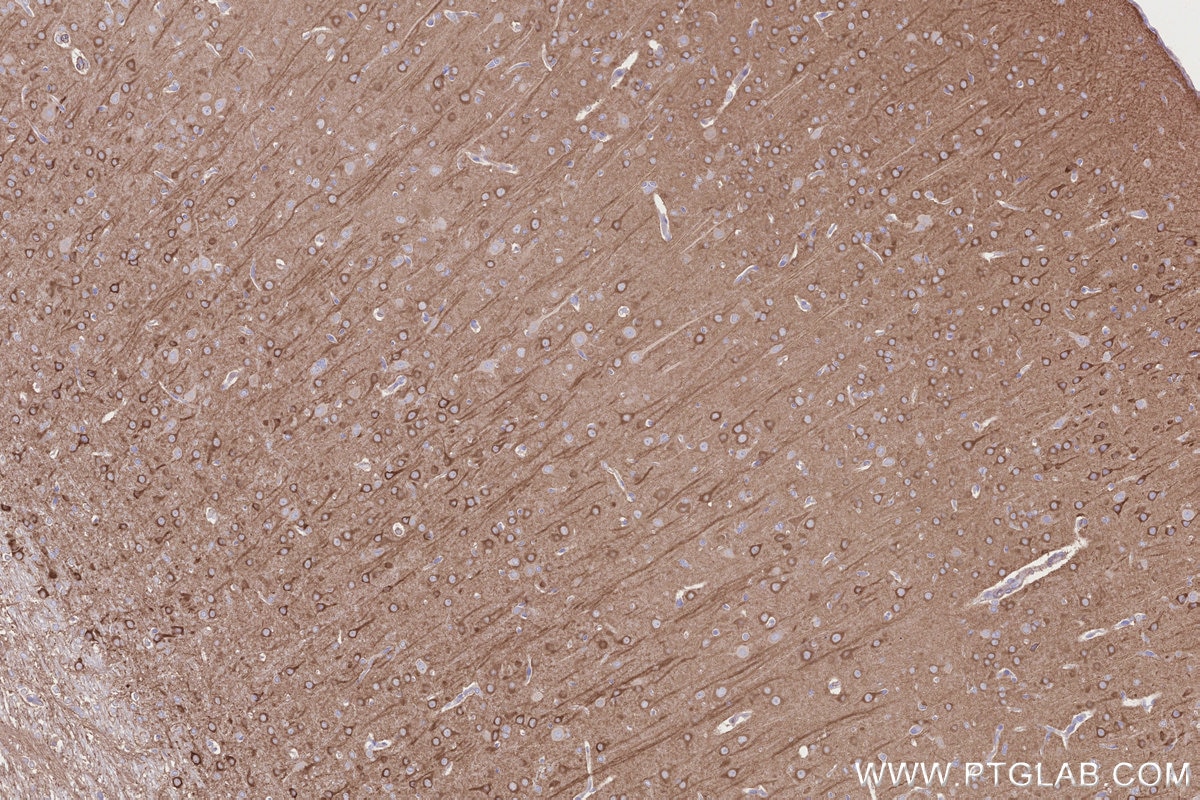 Immunohistochemistry (IHC) staining of rat brain tissue using NGEF Polyclonal antibody (30229-1-AP)
