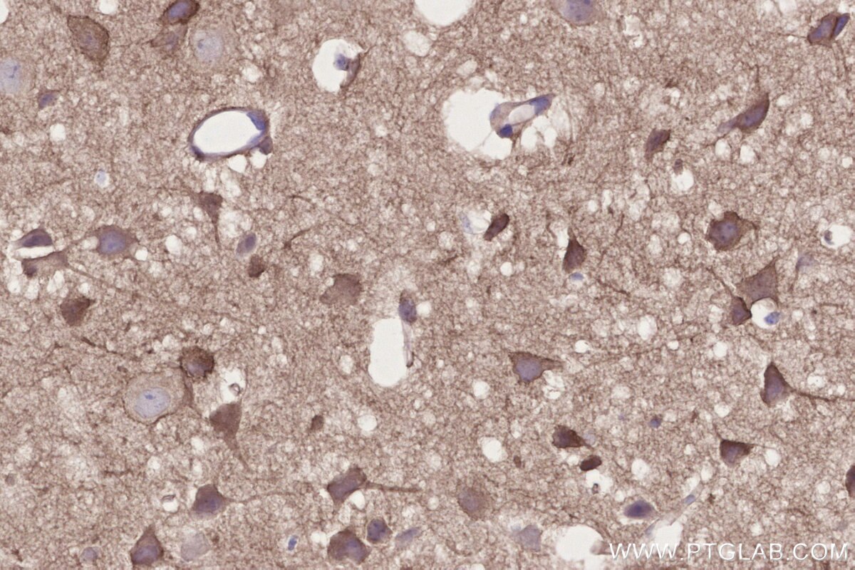 Immunohistochemistry (IHC) staining of mouse brain tissue using NGEF Polyclonal antibody (30229-1-AP)