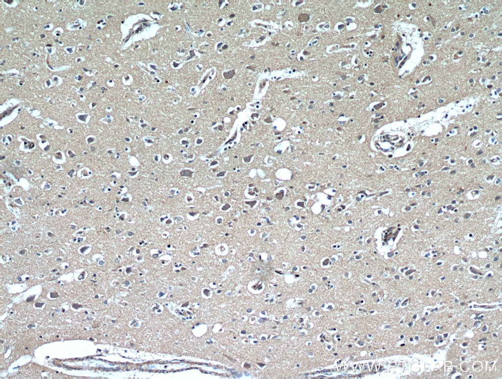 Immunohistochemistry (IHC) staining of human brain tissue using NGF Polyclonal antibody (20600-1-AP)