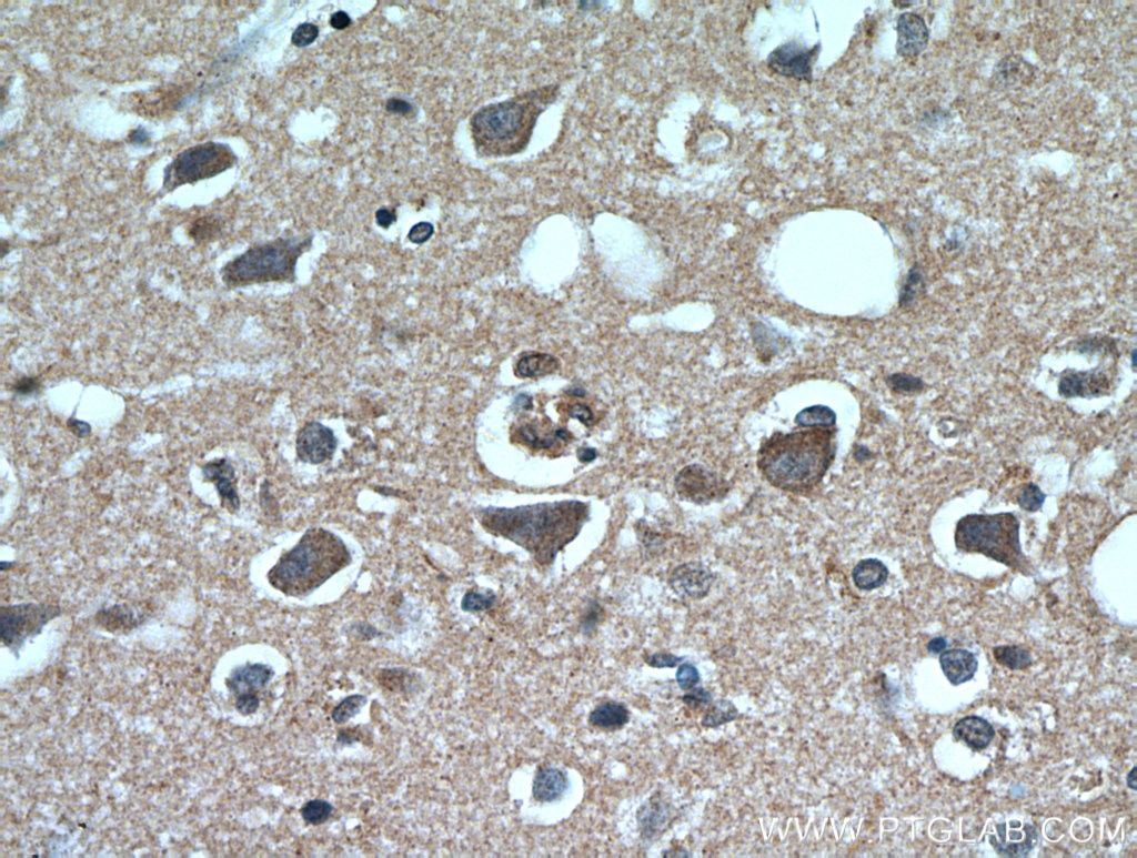 Immunohistochemistry (IHC) staining of human brain tissue using NGF Polyclonal antibody (20600-1-AP)