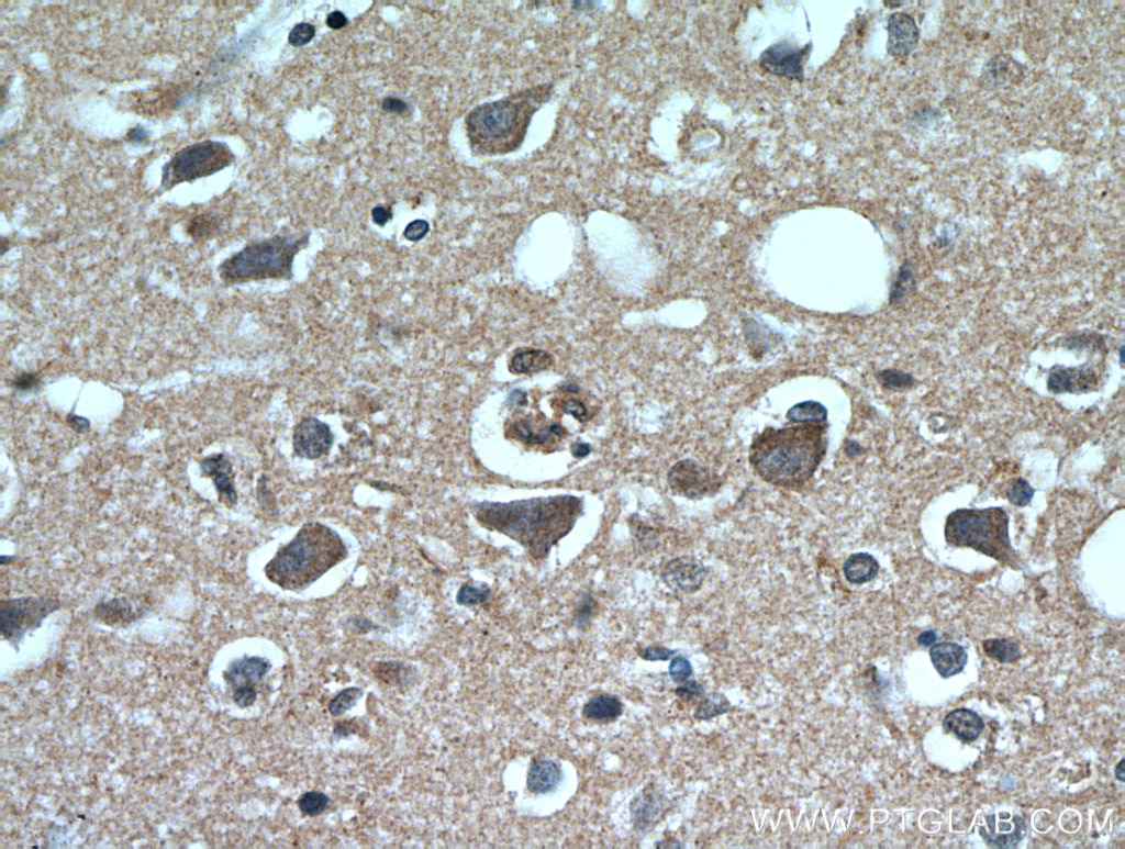 IHC staining of human brain using 20600-1-AP