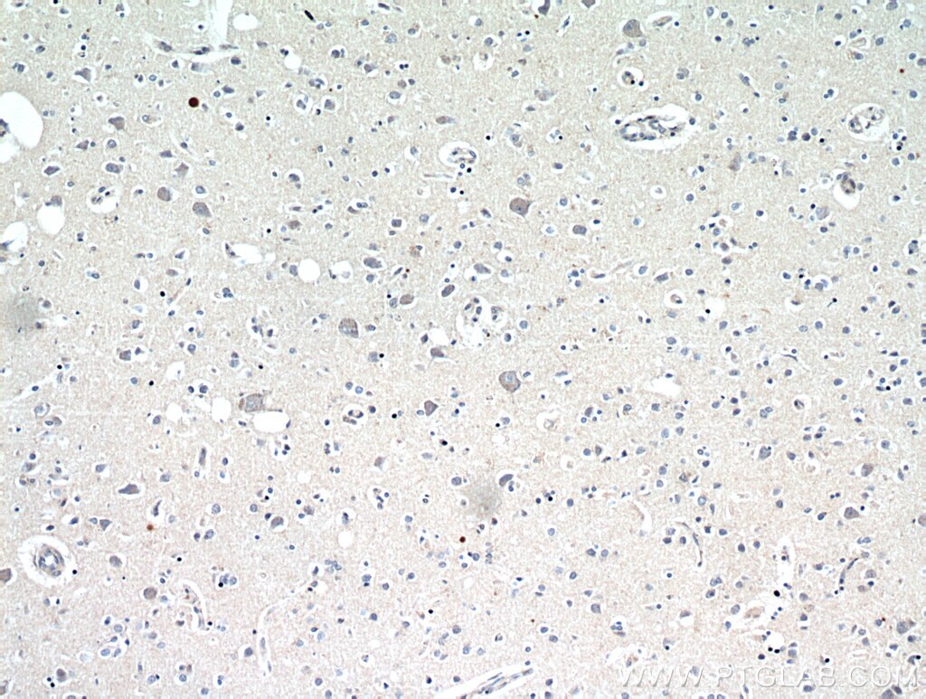 Immunohistochemistry (IHC) staining of human brain tissue using NGF Polyclonal antibody (20600-1-AP)