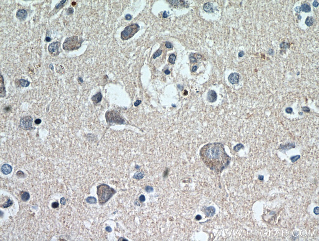 Immunohistochemistry (IHC) staining of human brain tissue using NGF Polyclonal antibody (20600-1-AP)