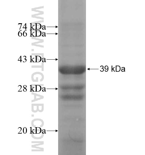 NGF fusion protein Ag14569 SDS-PAGE
