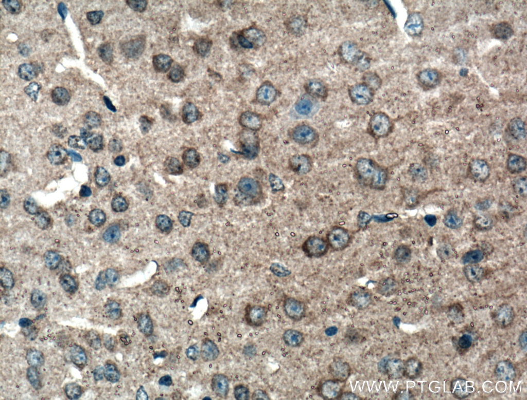 Immunohistochemistry (IHC) staining of mouse brain tissue using p75NTR Polyclonal antibody (55014-1-AP)