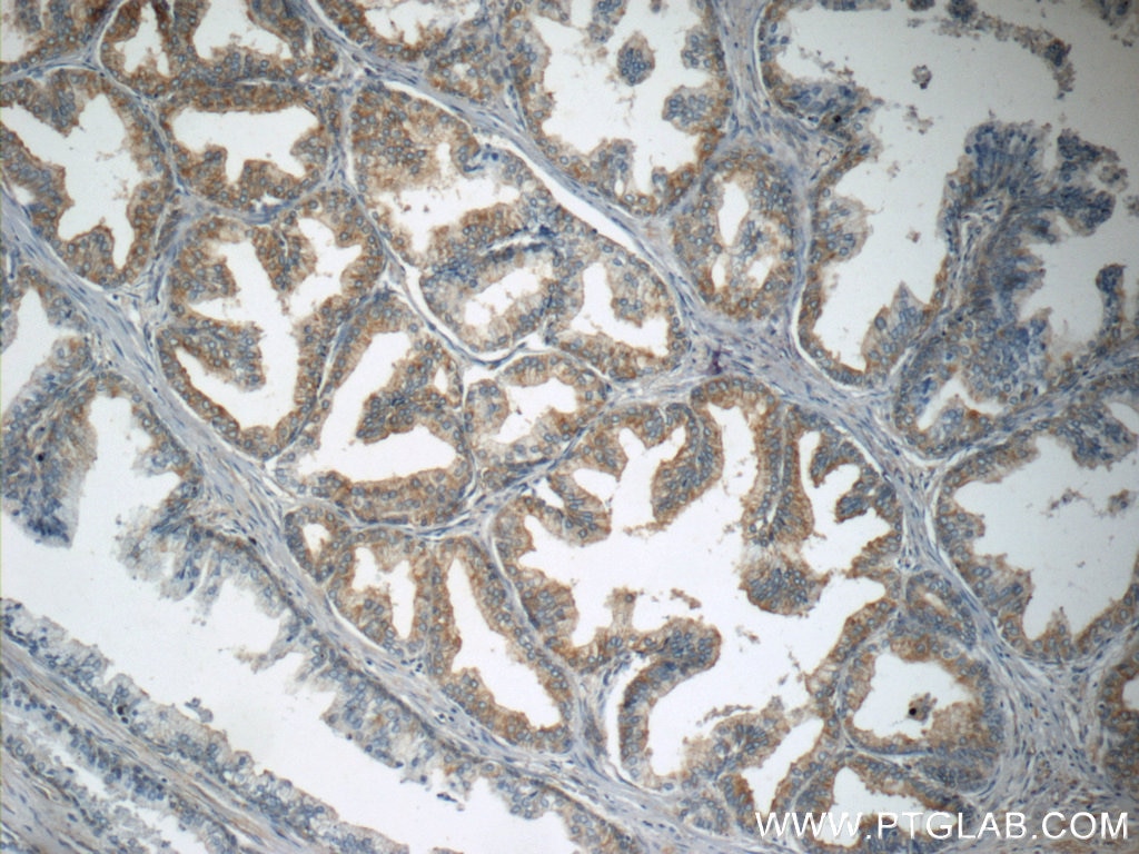 Immunohistochemistry (IHC) staining of human prostate hyperplasia tissue using p75NTR Polyclonal antibody (55014-1-AP)