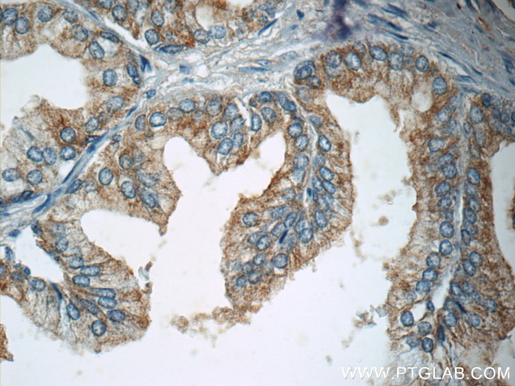 Immunohistochemistry (IHC) staining of human prostate hyperplasia tissue using p75NTR Polyclonal antibody (55014-1-AP)