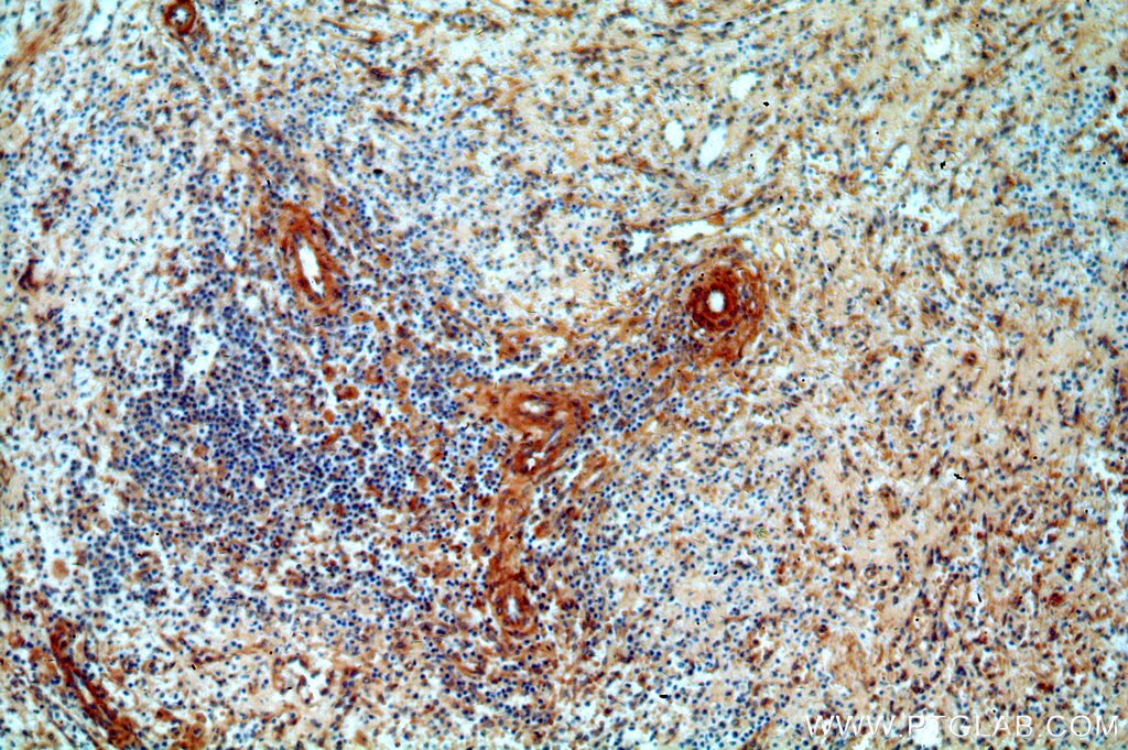 Immunohistochemistry (IHC) staining of human spleen tissue using p75NTR Polyclonal antibody (55014-1-AP)