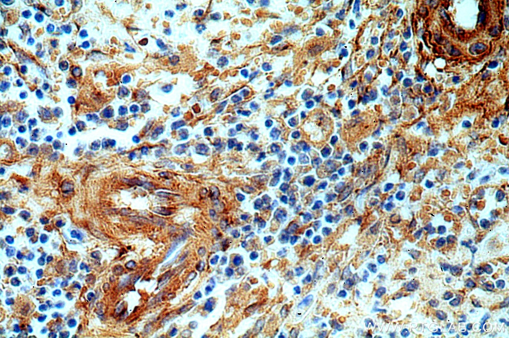 Immunohistochemistry (IHC) staining of human spleen tissue using p75NTR Polyclonal antibody (55014-1-AP)