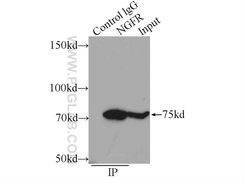 Immunoprecipitation (IP) experiment of mouse brain tissue using p75NTR Polyclonal antibody (55014-1-AP)